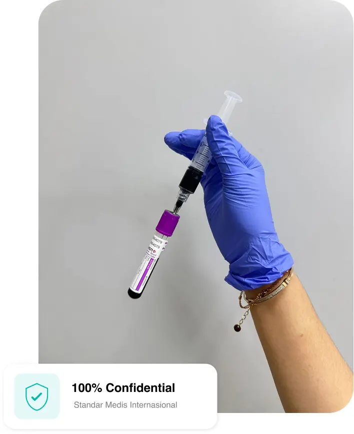 tes hiv rna jakarta surabaya