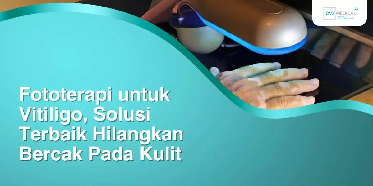 Fototerapi untuk Vitiligo, Solusi Terbaik Hilangkan Bercak Pada Kulit