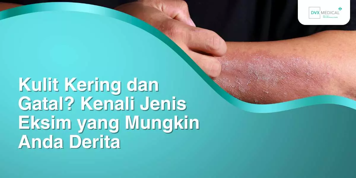 Kulit Kering dan Gatal? Kenali Jenis Eksim yang Mungkin Anda Derita