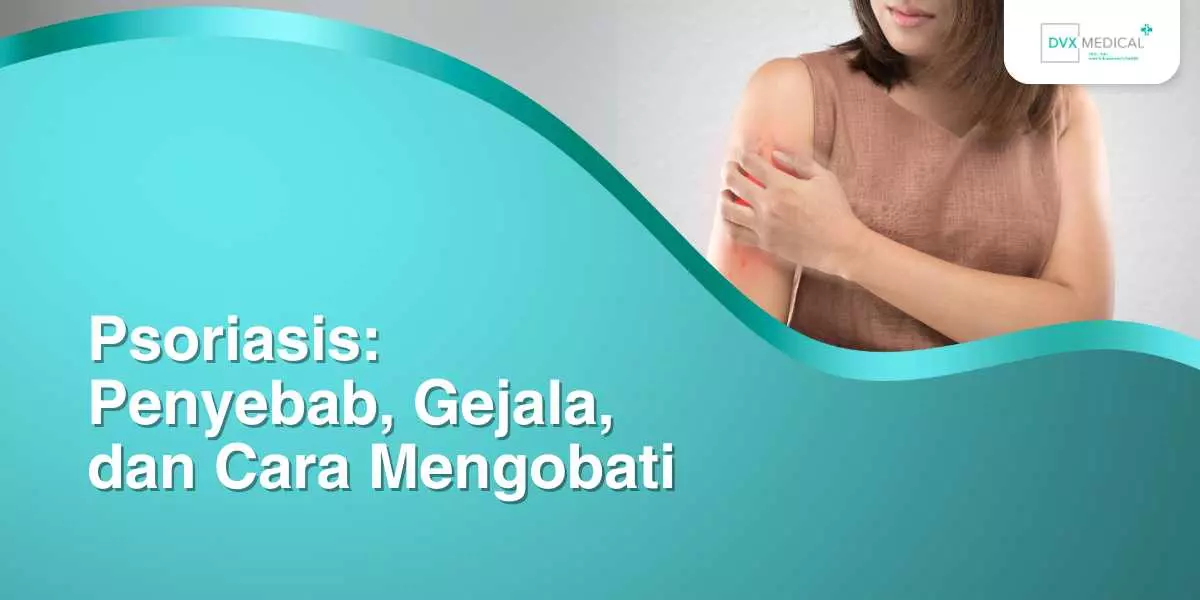 Psoriasis: Penyebab, Gejala, dan Cara Mengobati