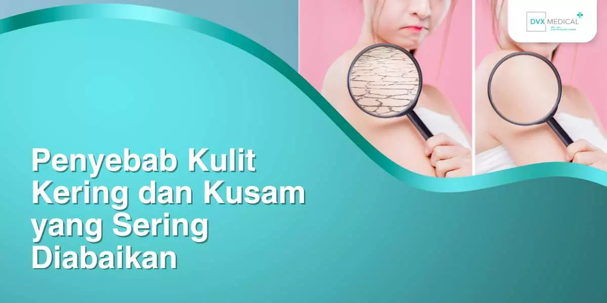 Penyebab Kulit Kering dan Kusam yang Sering Diabaikan