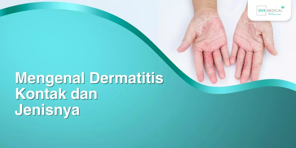 Mengenal Dermatitis Kontak dan Jenisnya