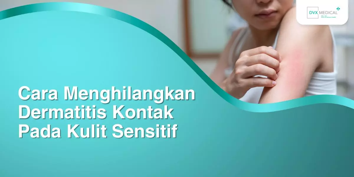 Cara Menghilangkan Dermatitis Kontak Pada Kulit Sensitif
