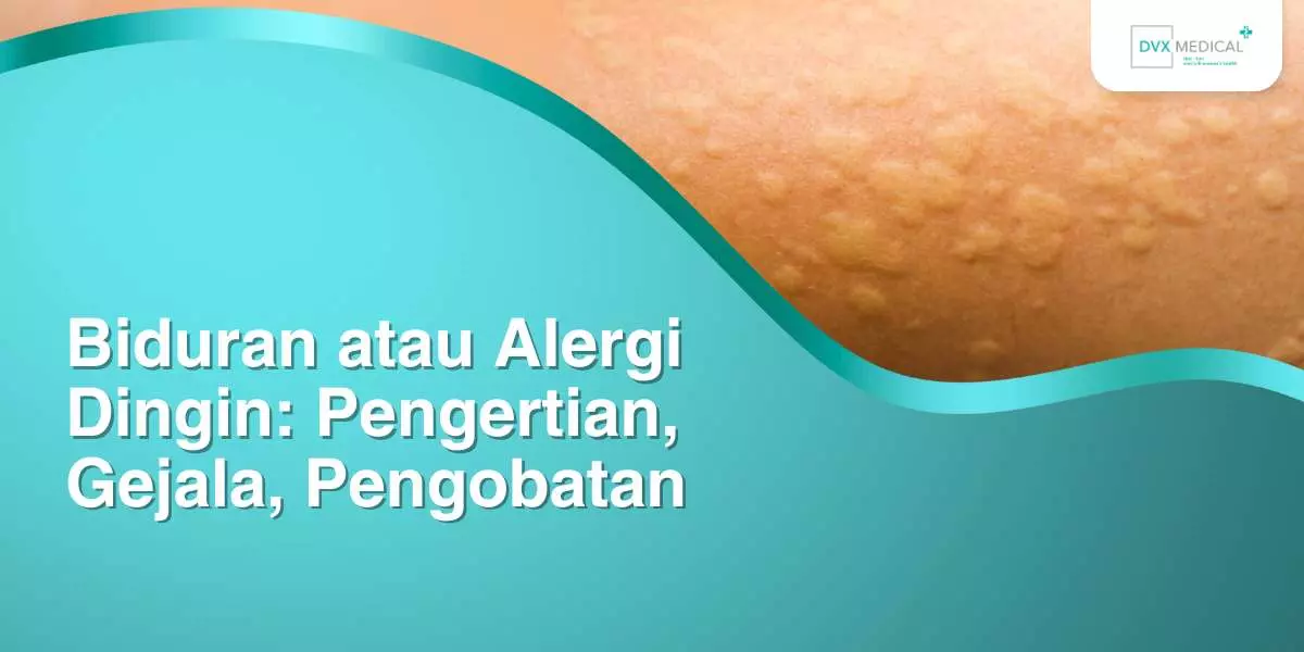 Biduran atau Alergi Dingin: Pengertian, Gejala, Pengobatan