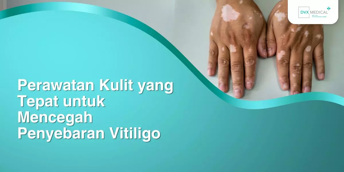 Perawatan Kulit yang Tepat untuk Mencegah Penyebaran Vitiligo