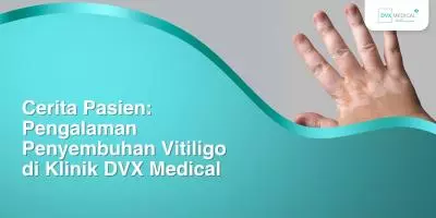 Cerita Pasien: Pengalaman Penyembuhan Vitiligo di Klinik DVX Medical