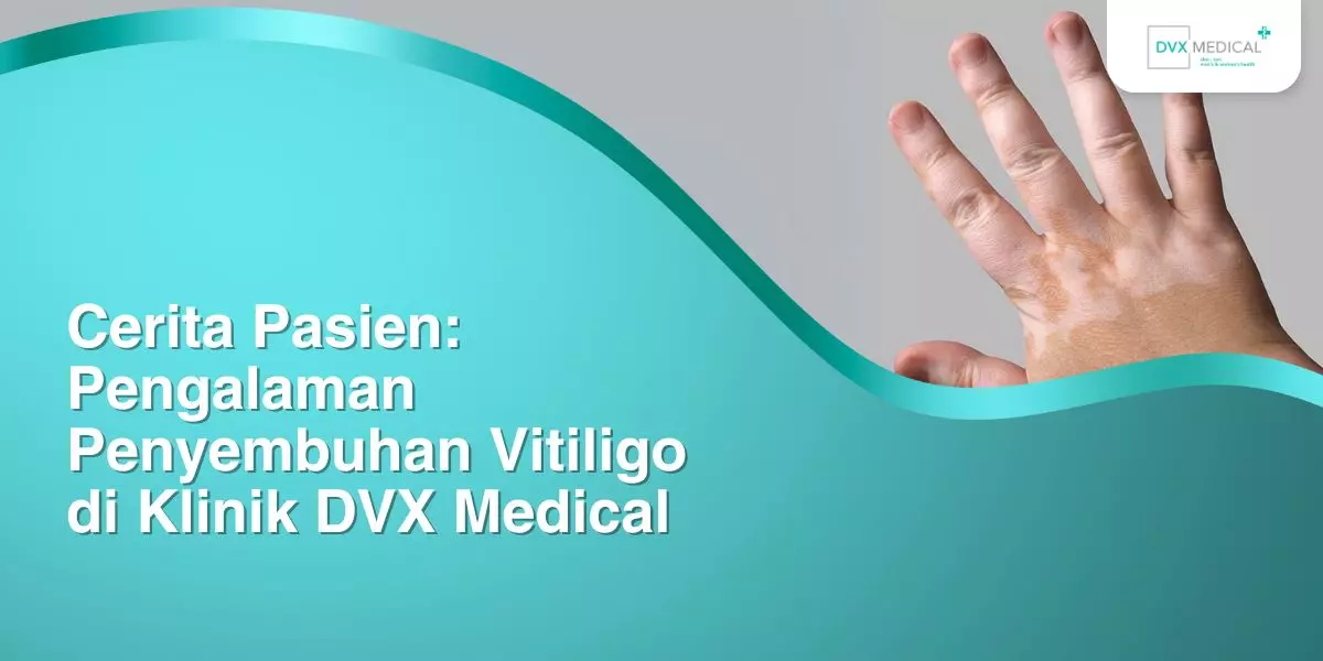 Cerita Pasien: Pengalaman Penyembuhan Vitiligo di Klinik DVX Medical
