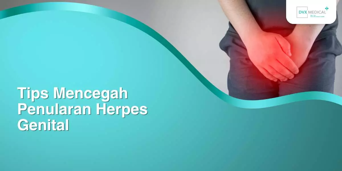 Tips Mencegah Penularan Herpes Genital