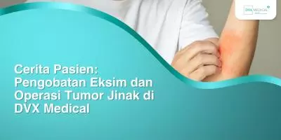 Cerita Pasien: Pengobatan Eksim dan Operasi Tumor Jinak di DVX Medical