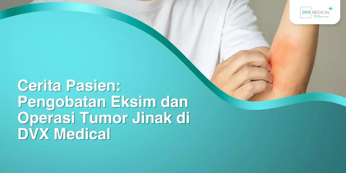 Cerita Pasien: Pengobatan Eksim dan Operasi Tumor Jinak di DVX Medical