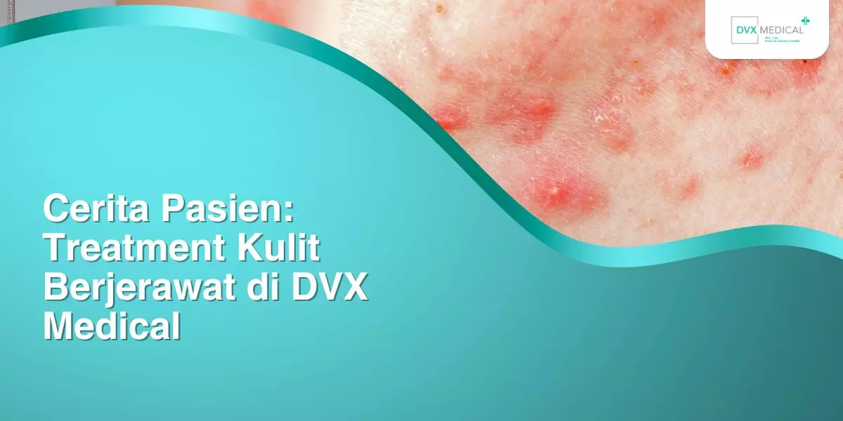 Cerita Pasien: Treatment Kulit Berjerawat di DVX Medical