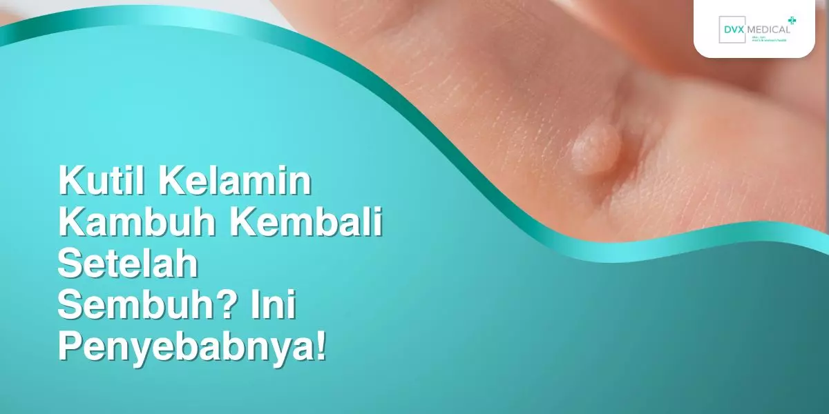 Kutil Kelamin Kambuh Kembali Setelah Sembuh? Ini Penyebabnya! Lakukan Pemeriksaan di DVX Jakarta