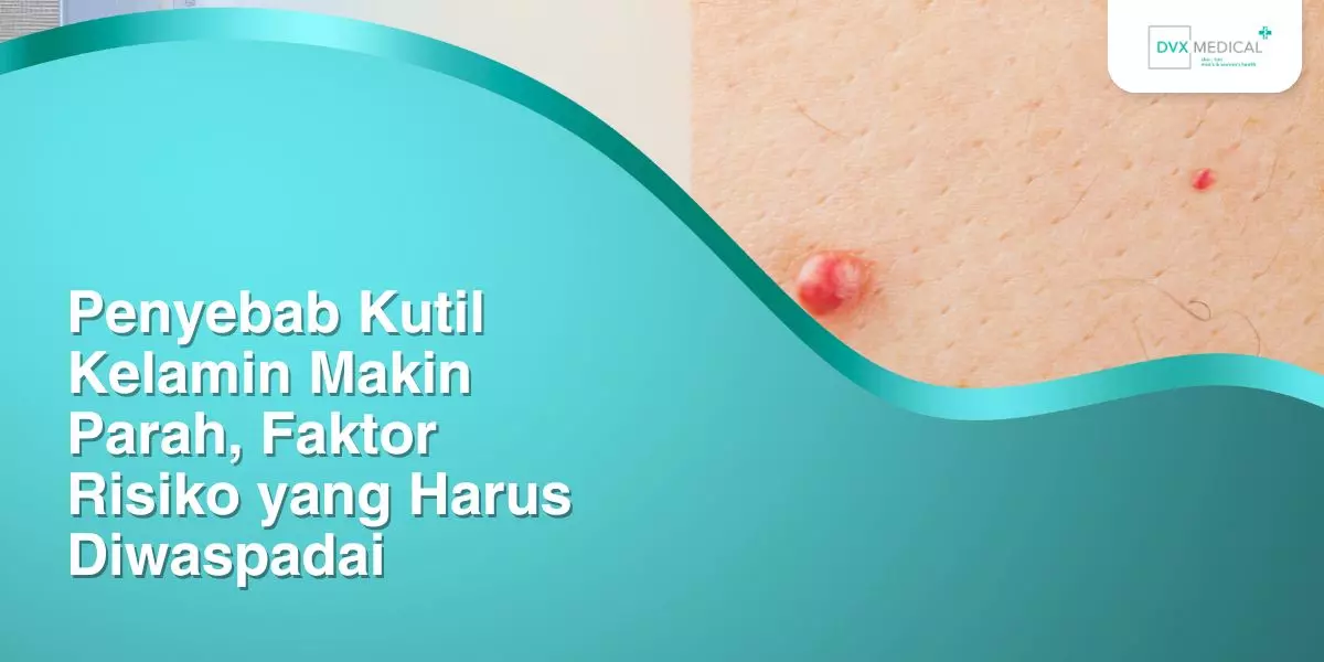 Penyebab Kutil Kelamin Makin Parah, Faktor Risiko yang Harus Diwaspadai