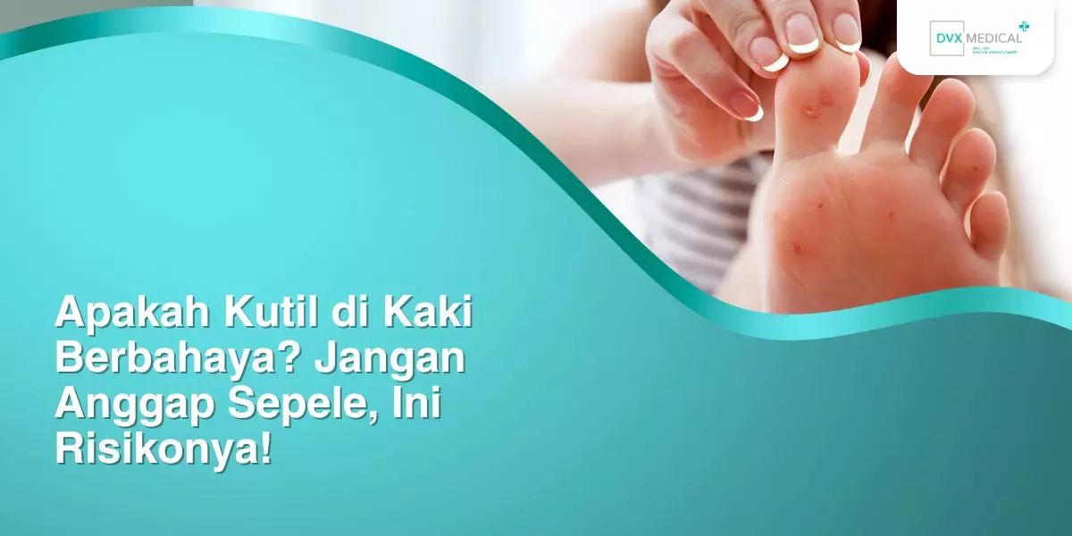 Apakah Kutil di Kaki Berbahaya? Jangan Anggap Sepele, Ini Risikonya!