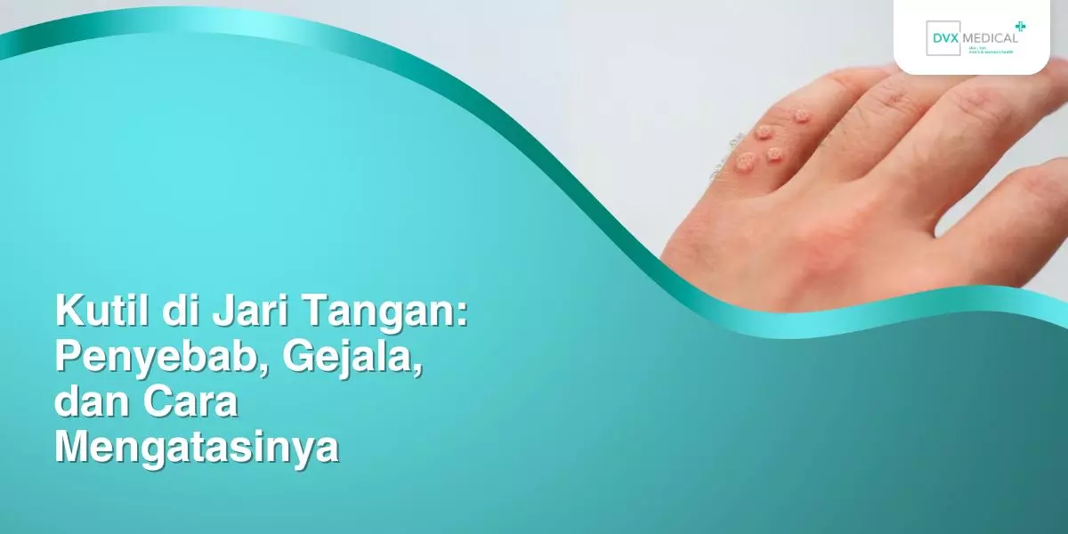 Kutil di Jari Tangan: Penyebab, Gejala, dan Cara Mengatasinya