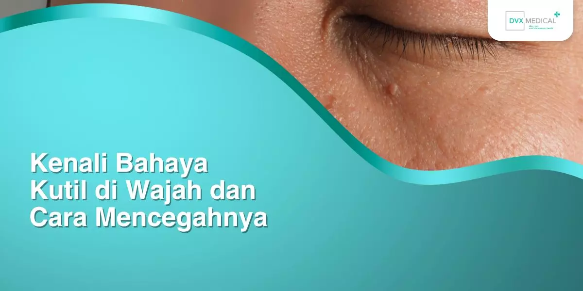 Kenali Bahaya Kutil di Wajah dan Cara Mencegahnya