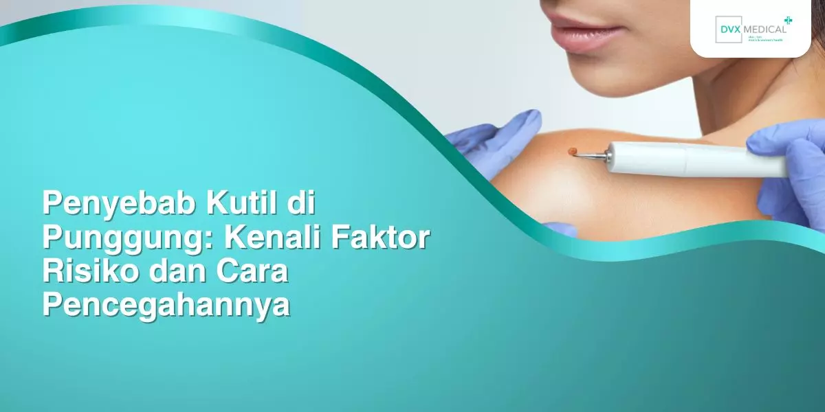 Penyebab Kutil di Punggung: Kenali Faktor Risiko dan Cara Pencegahannya