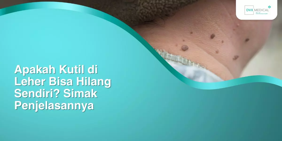 Apakah Kutil di Leher Bisa Hilang Sendiri? Simak Penjelasannya