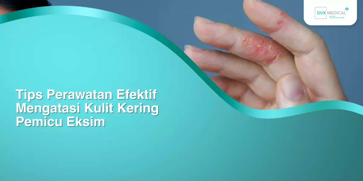 Tips Perawatan Efektif Mengatasi Kulit Kering Pemicu Eksim
