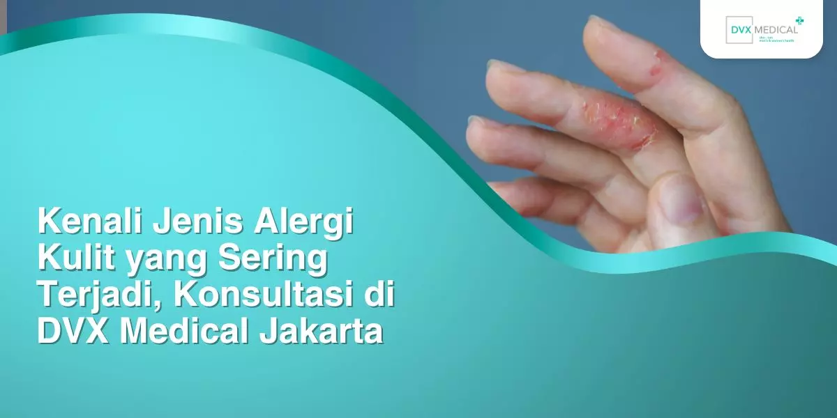 Kenali Jenis Alergi Kulit yang Sering Terjadi, Konsultasi di DVX Medical Jakarta