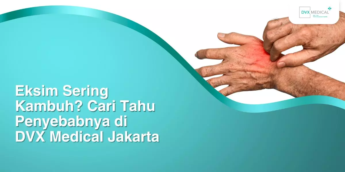 Eksim Sering Kambuh? Cari Tahu Penyebabnya di DVX Medical Jakarta