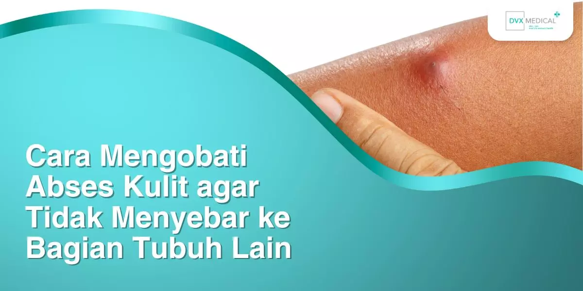 Cara Mengobati Abses Kulit agar Tidak Menyebar ke Bagian Tubuh Lain