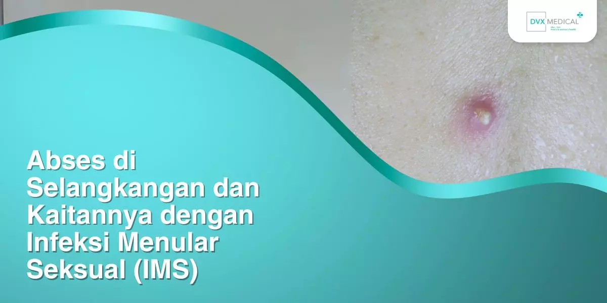 Abses di Selangkangan dan Kaitannya dengan Infeksi Menular Seksual (IMS)