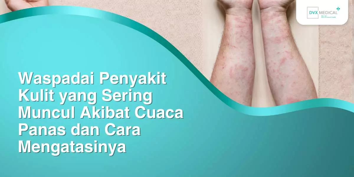 Waspadai Penyakit Kulit yang Sering Muncul Akibat Cuaca Panas dan Cara Mengatasinya