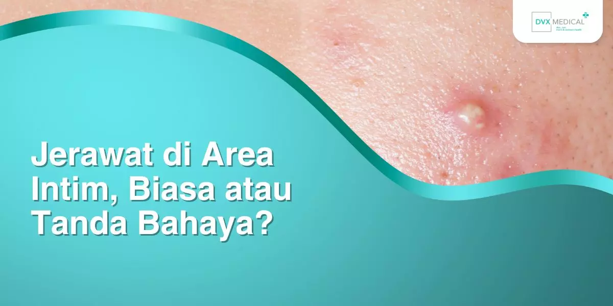 Jerawat di Area Intim, Biasa atau Tanda Bahaya?