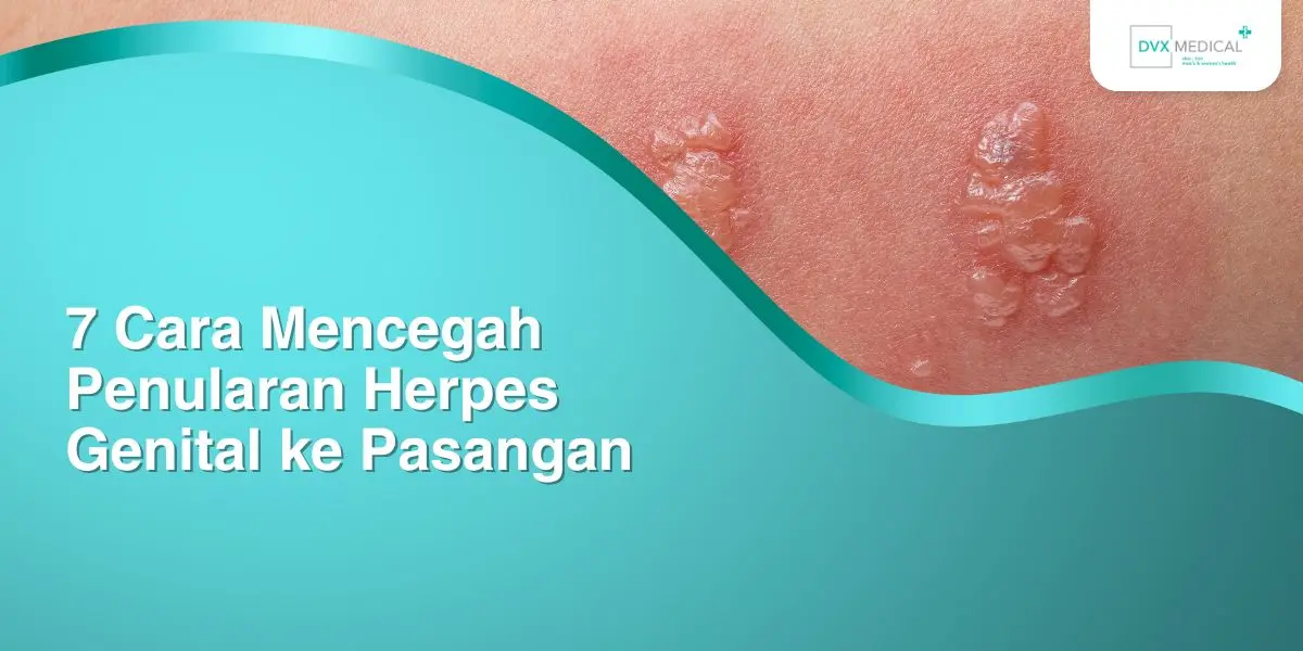 7 Cara Mencegah Penularan Herpes Genital ke Pasangan