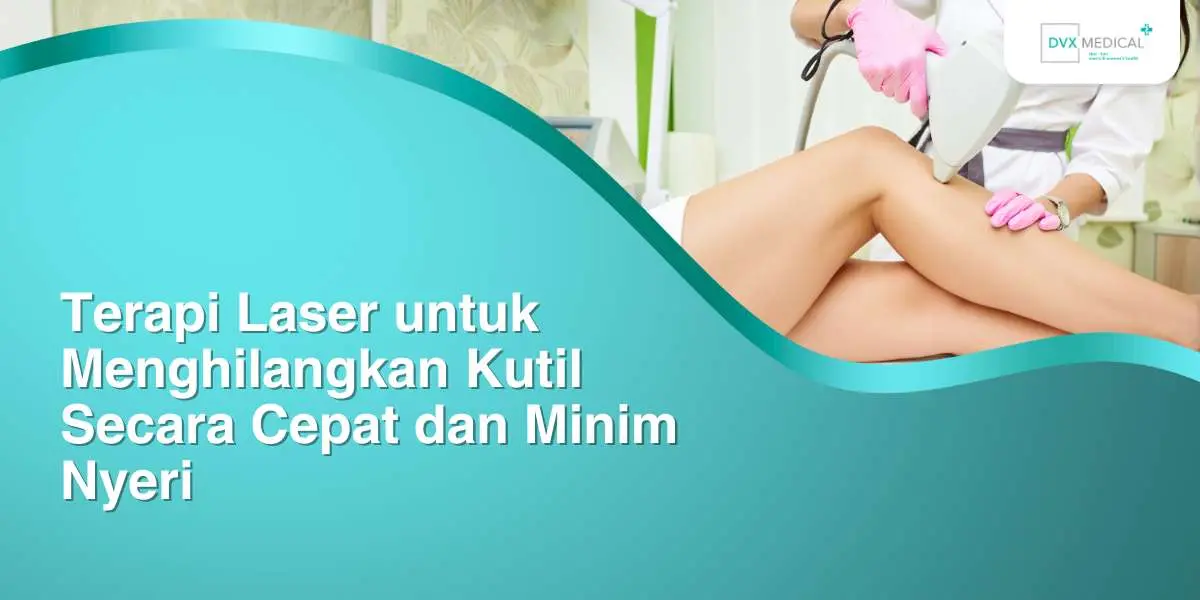 Terapi Laser untuk Menghilangkan Kutil Secara Cepat dan Minim Nyeri