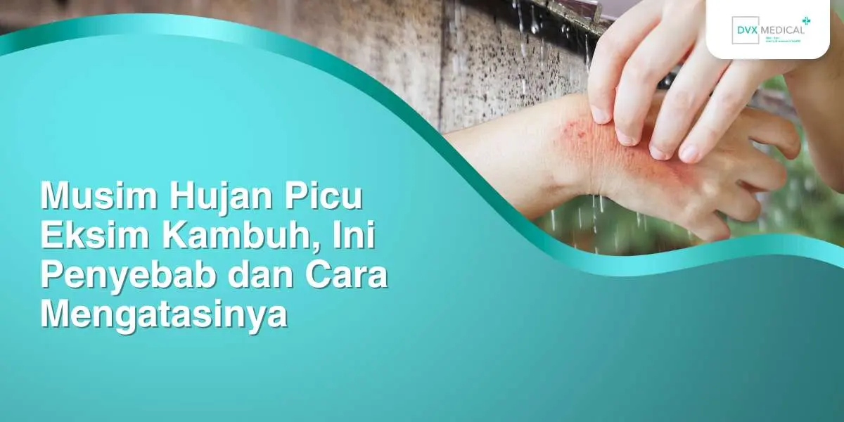 Musim Hujan Picu Eksim Kambuh, Ini Penyebab dan Cara Mengatasinya