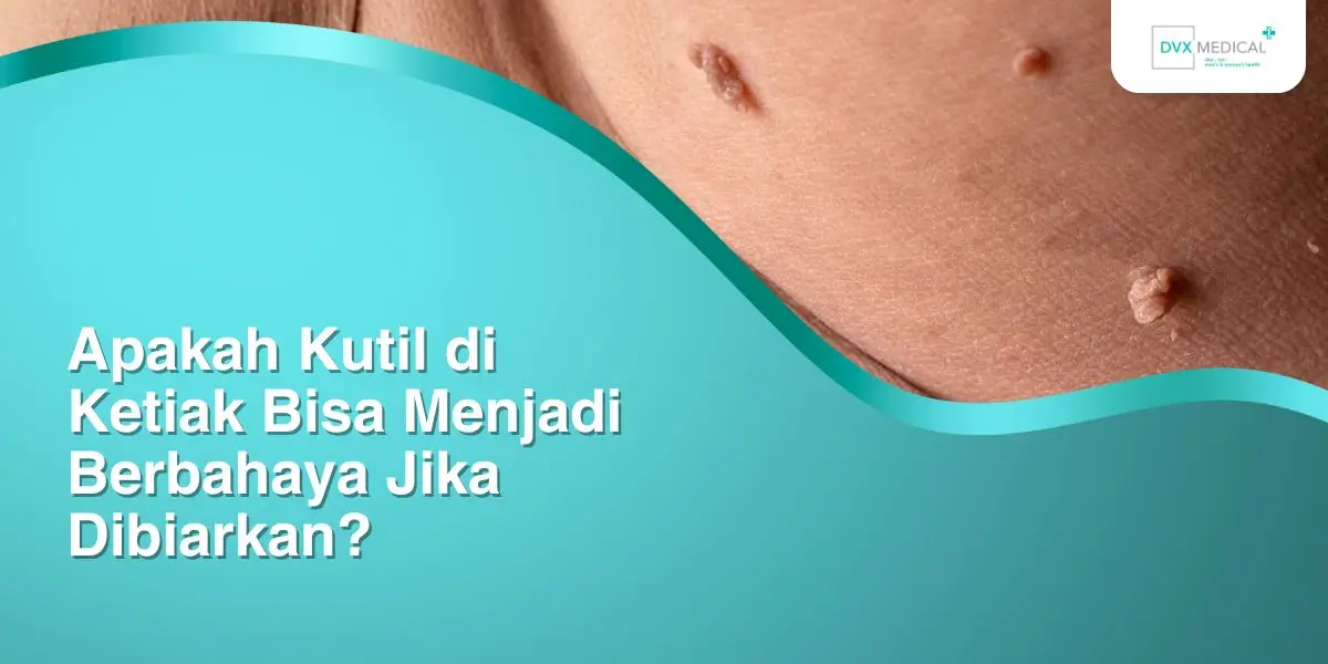 Apakah Kutil di Ketiak Bisa Menjadi Berbahaya Jika Dibiarkan?
