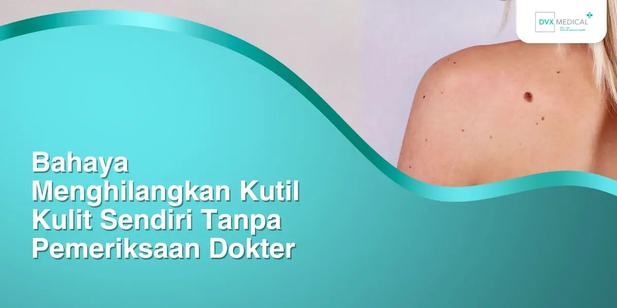 Bahaya Menghilangkan Kutil Kulit Sendiri Tanpa Pemeriksaan Dokter