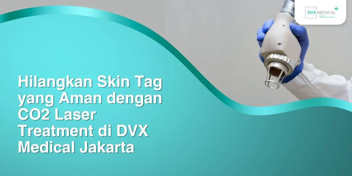 Hilangkan Skin Tag yang Aman dengan CO2 Laser Treatment di DVX Medical Jakarta