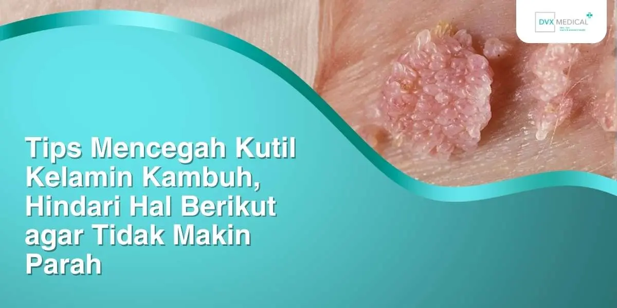 Tips Mencegah Kutil Kelamin Kambuh, Hindari Hal Berikut agar Tidak Makin Parah