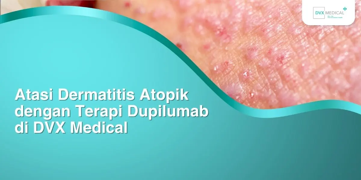 Atasi Dermatitis Atopik dengan Terapi Dupilumab di DVX Medical