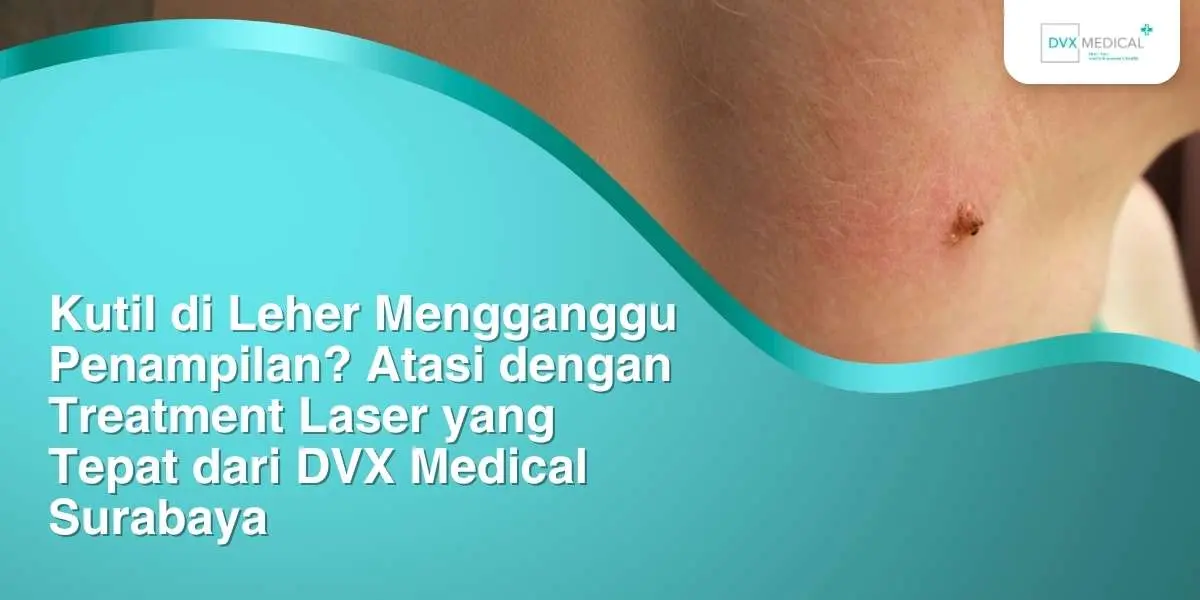Kutil di Leher Mengganggu Penampilan? Atasi dengan Treatment Laser yang Tepat dari DVX Medical Surabaya