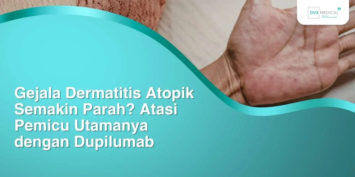 Gejala Dermatitis Atopik Semakin Parah? Atasi Pemicu Utamanya dengan Dupilumab