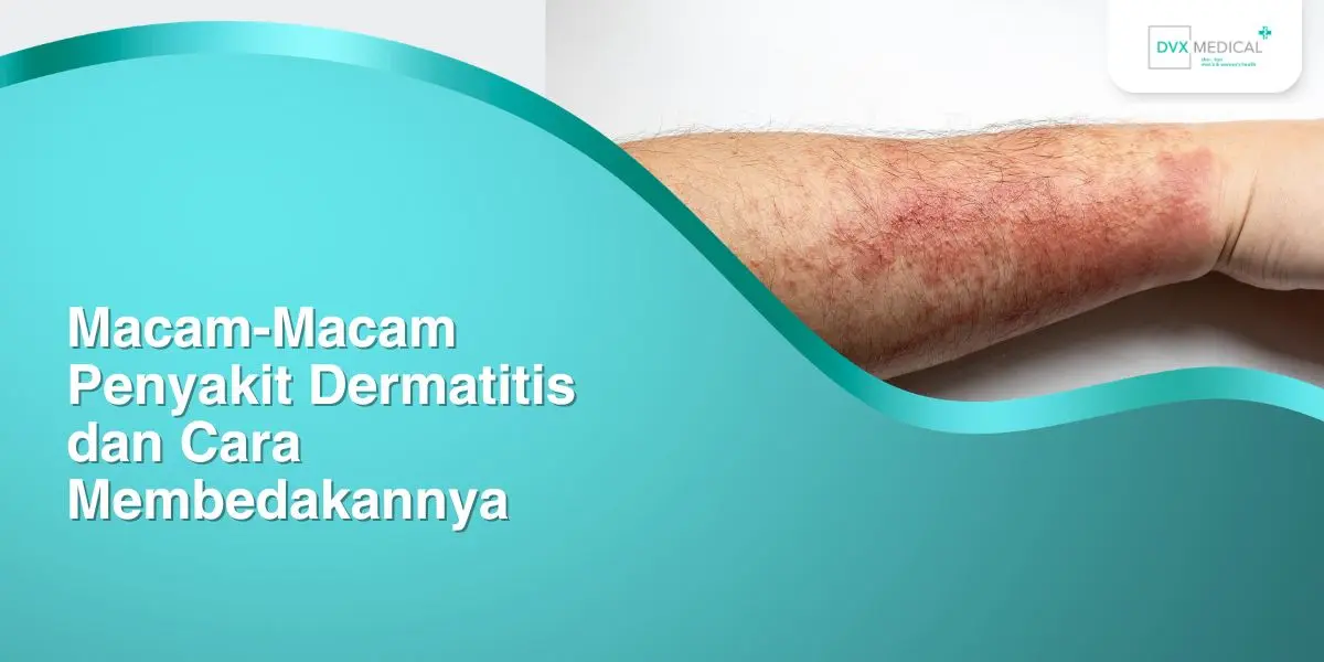 Macam-Macam Penyakit Dermatitis dan Cara Membedakannya