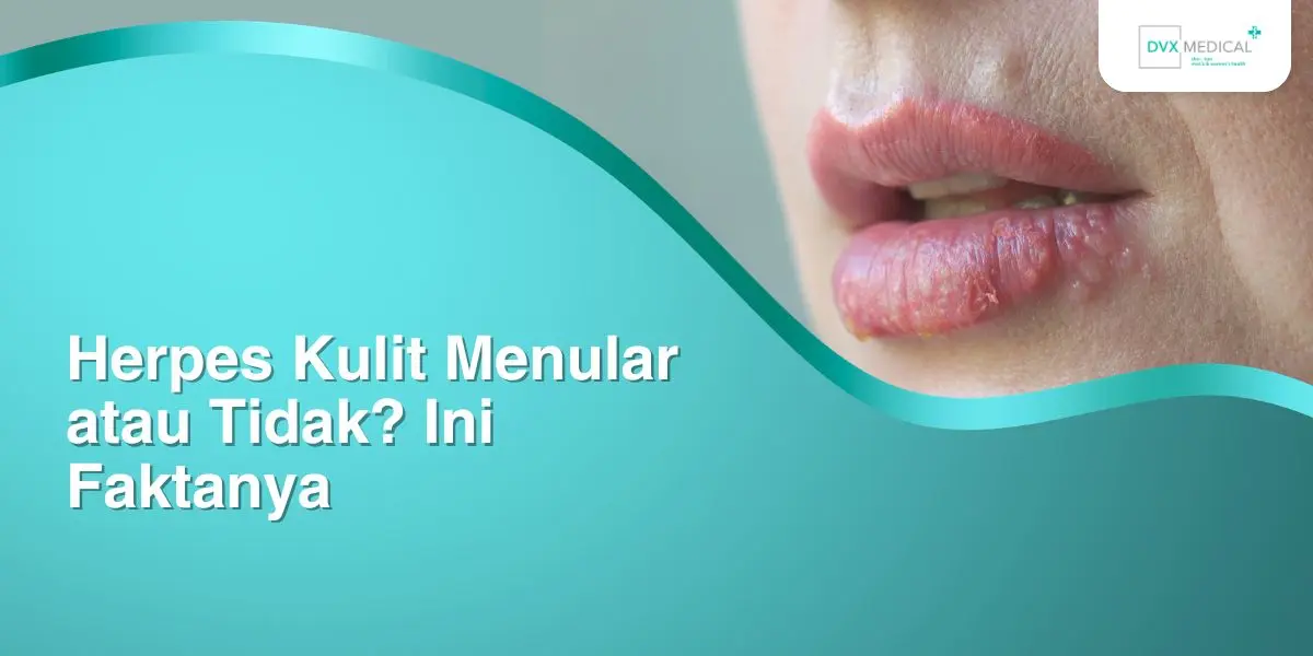 Herpes Kulit Menular atau Tidak? Ini Faktanya
