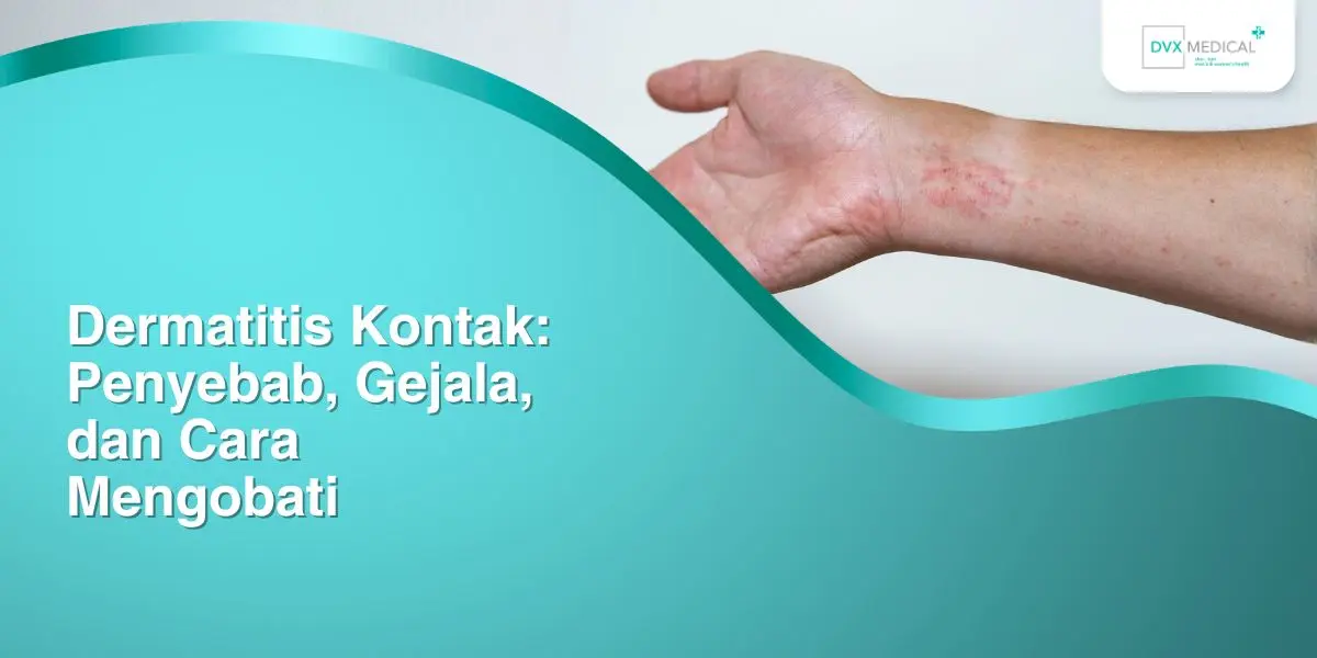 Dermatitis Kontak: Penyebab, Gejala, dan Cara Mengobati