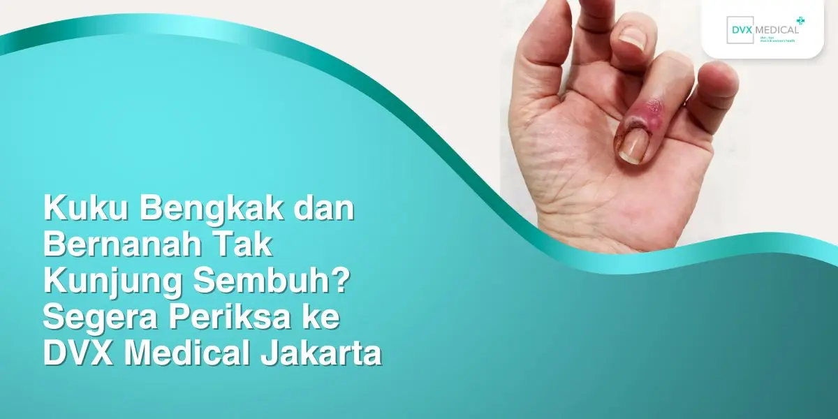 Kuku Bengkak dan Bernanah Tak Kunjung Sembuh? Segera Periksa ke DVX Medical Jakarta