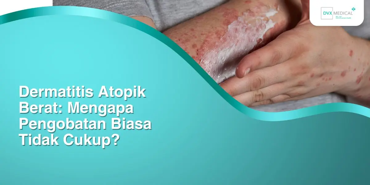 Dermatitis Atopik Berat: Mengapa Pengobatan Biasa Tidak Cukup?