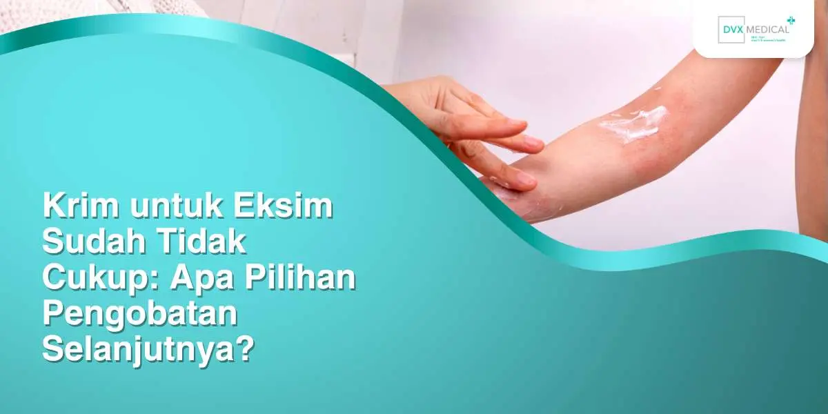 Krim untuk Eksim Sudah Tidak Cukup: Apa Pilihan Pengobatan Selanjutnya?