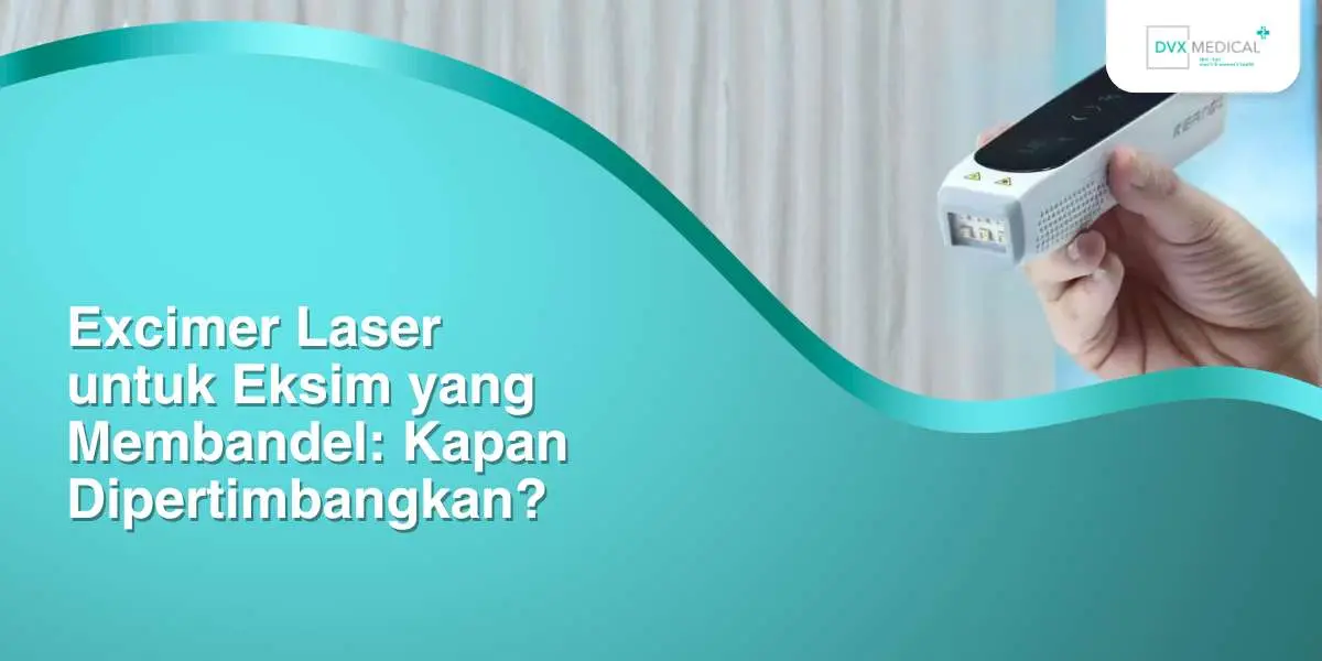 Excimer Laser untuk Eksim yang Membandel: Kapan Dipertimbangkan?