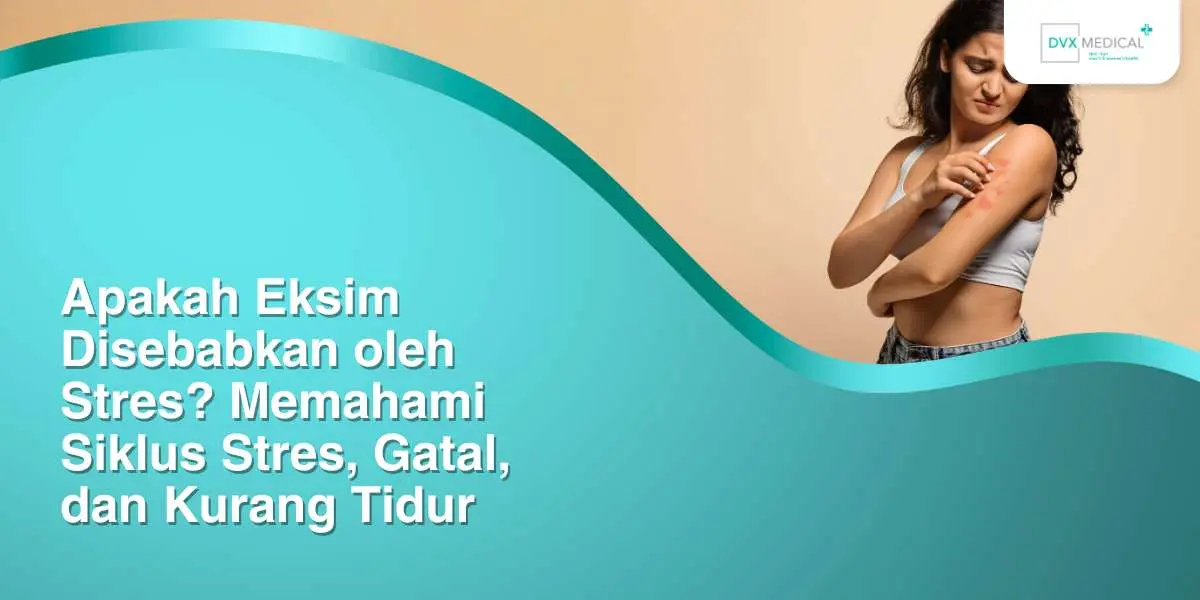 Apakah Eksim Disebabkan oleh Stres? Memahami Siklus Stres, Gatal, dan Kurang Tidur