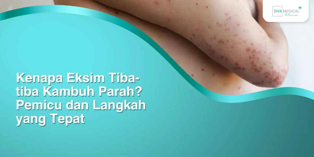 Kenapa Eksim Tiba-tiba Kambuh Parah? Pemicu dan Langkah yang Tepat