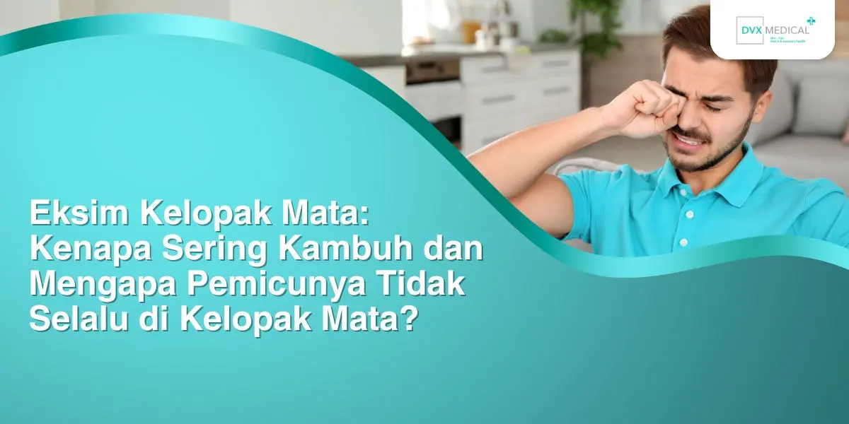 Eksim Kelopak Mata: Kenapa Sering Kambuh dan Mengapa Pemicunya Tidak Selalu di Kelopak Mata?