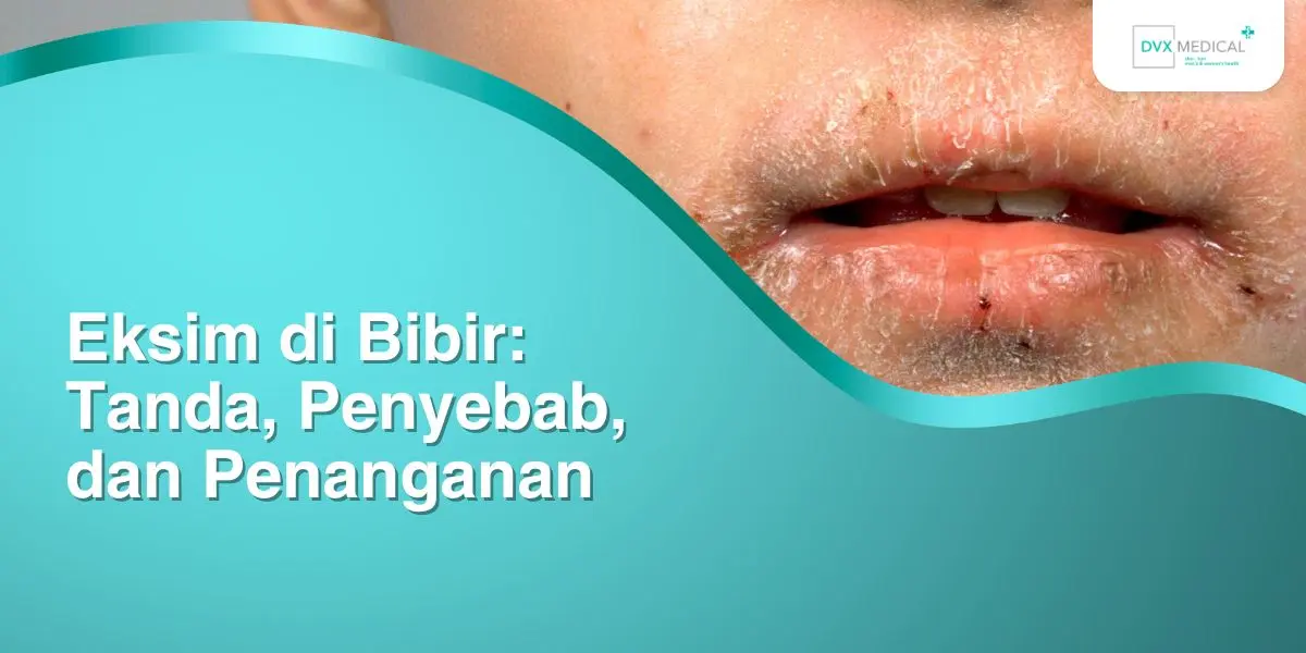 Eksim di Bibir: Tanda, Penyebab, dan Penanganan